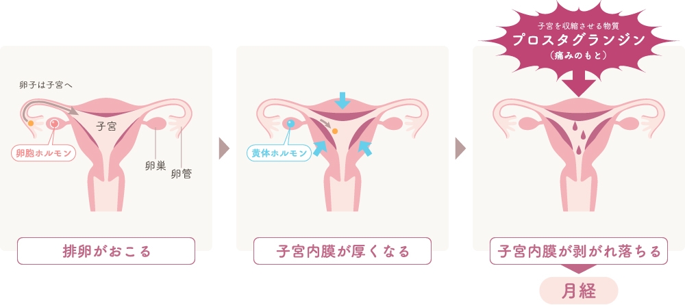 機能性月経困難症