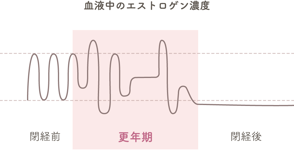 更年期障害の原因