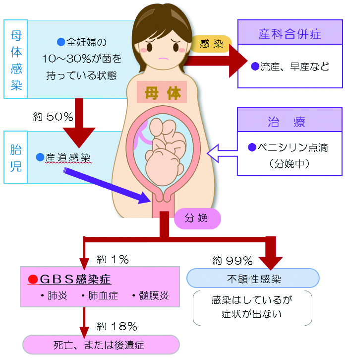 B群溶血性連鎖球菌（GBS） 木野産婦人科医院